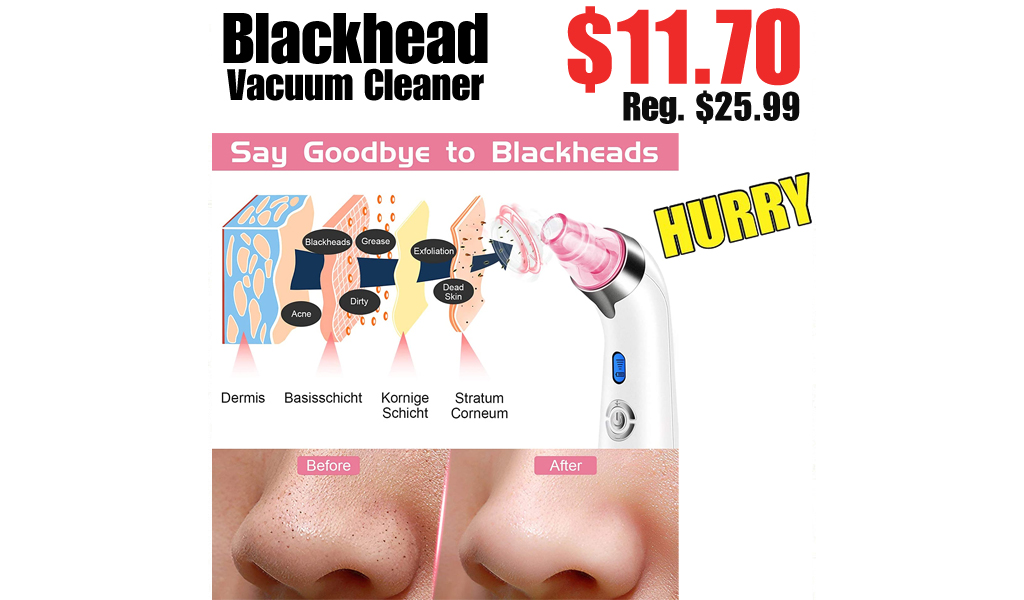 Blackhead Vacuum Cleaner Only $11.70 on Amazon (Regularly $25.99)