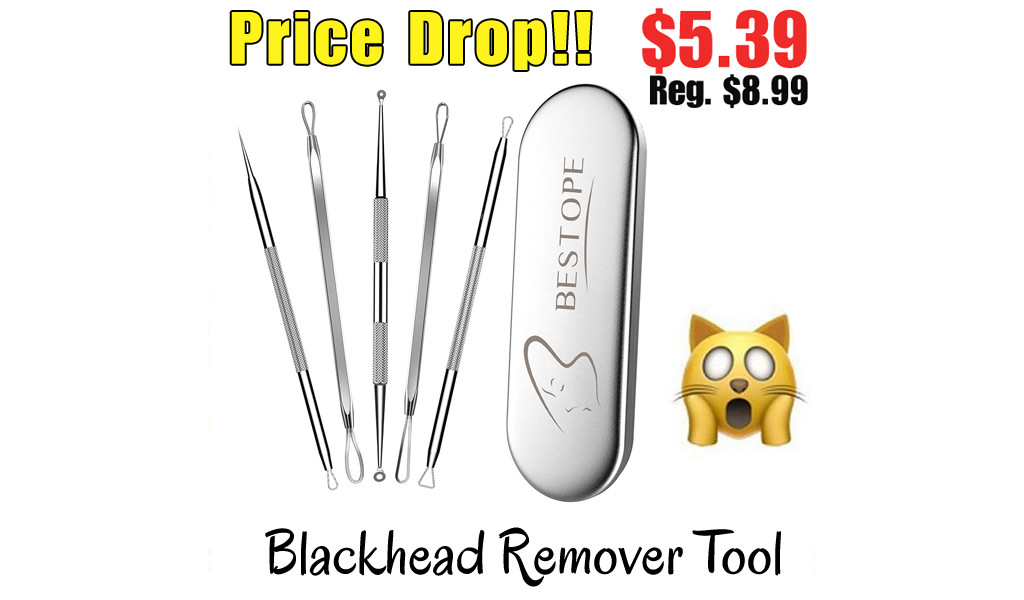 Blackhead Remover Tool Only $5.39 Shipped on Amazon (Regularly $8.99)