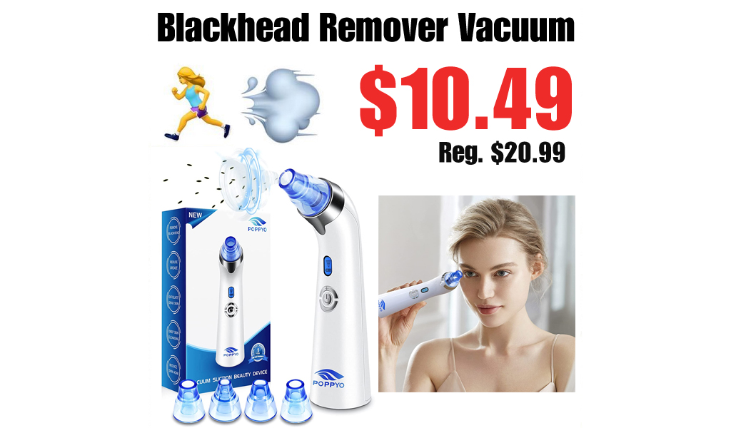 Blackhead Remover Vacuum Only $10.49 Shipped on Amazon (Regularly $20.99)