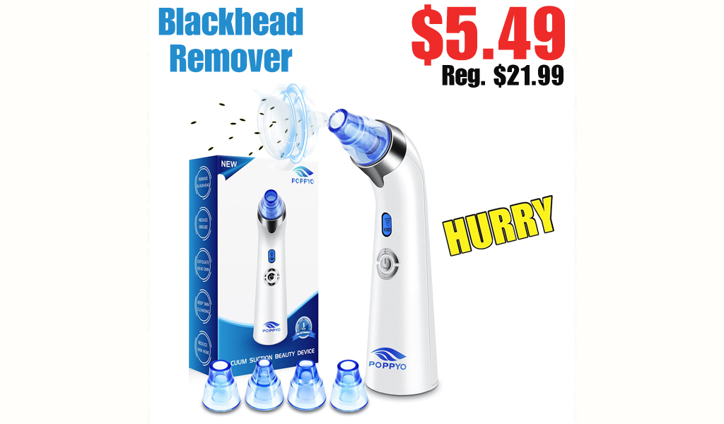 Blackhead Remover Only $5.49 Shipped on Amazon (Regularly $21.99)