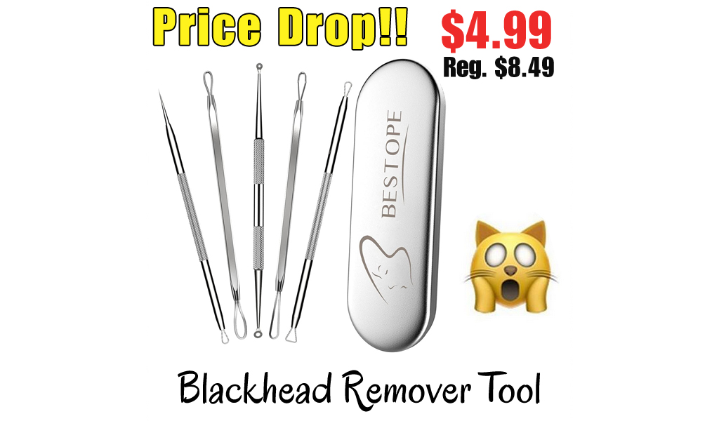 Blackhead Remover Tool Only $4.99 Shipped on Amazon (Regularly $8.49)